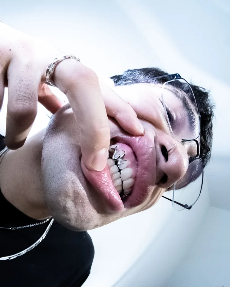 Grillz von Chopper Couture, getragen