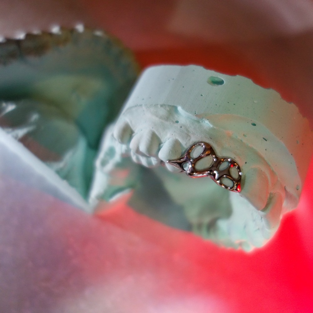 Custom Grillz Einzelstück — Dental Jewelry Chopper Couture