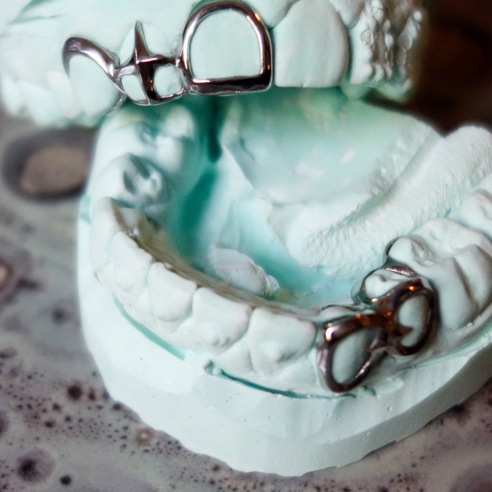 Dental Jewelry Einzelzahn — individueller Zahnschmuck aus CoCr