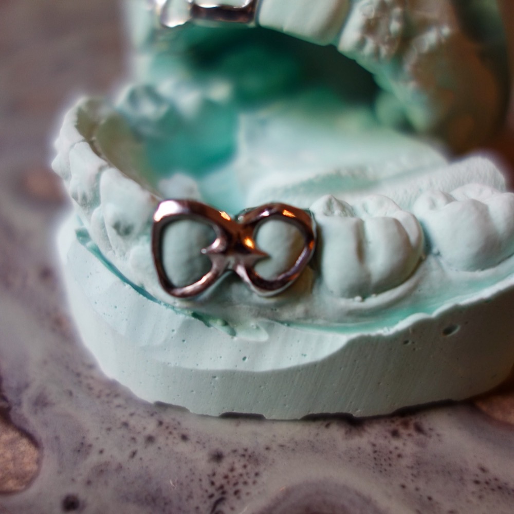 Grillz Detailansicht — Zahnschmuck Nahaufnahme