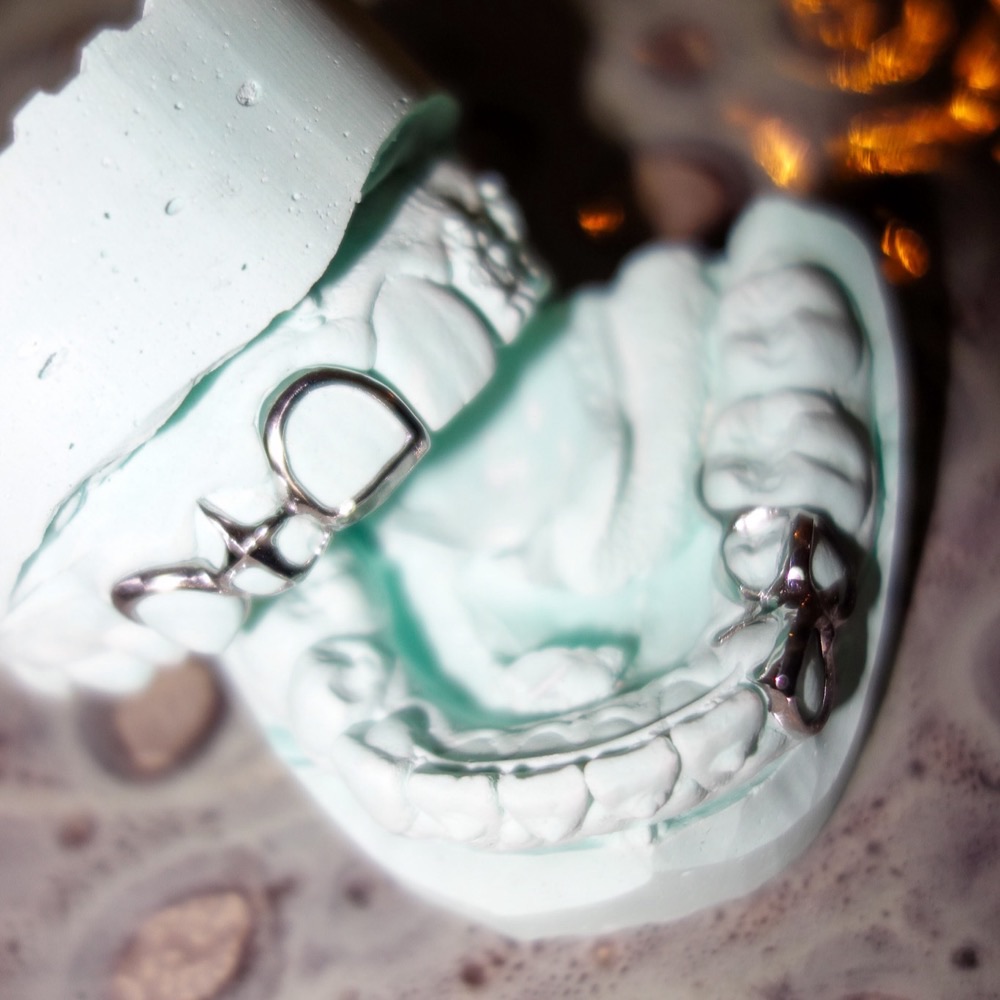 Custom Grillz auf Zahnmodell — Chopper Couture Design