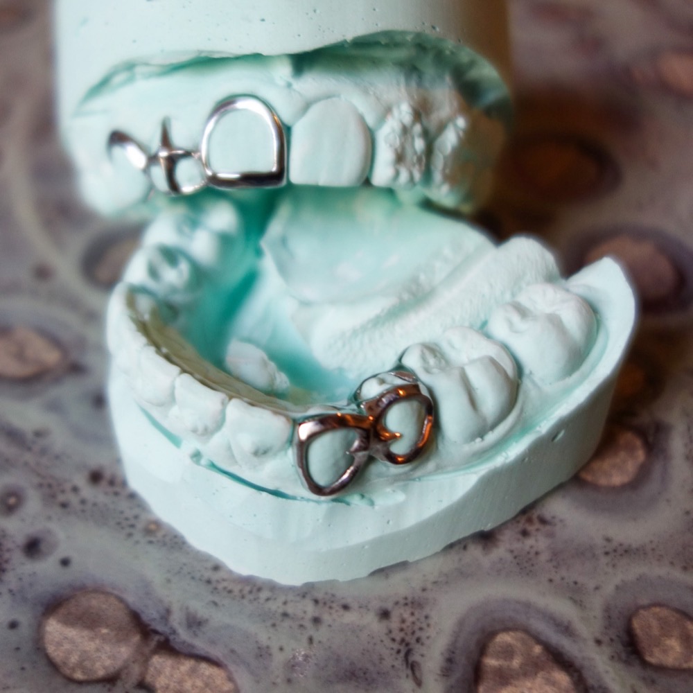 Zahnschmuck mit Ornament — handpolierter Grillz