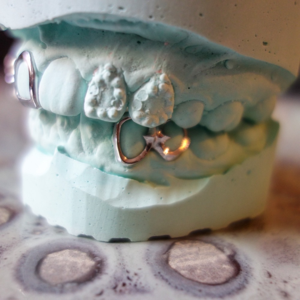 Dental Grillz seitliche Ansicht — Custom Design Berlin