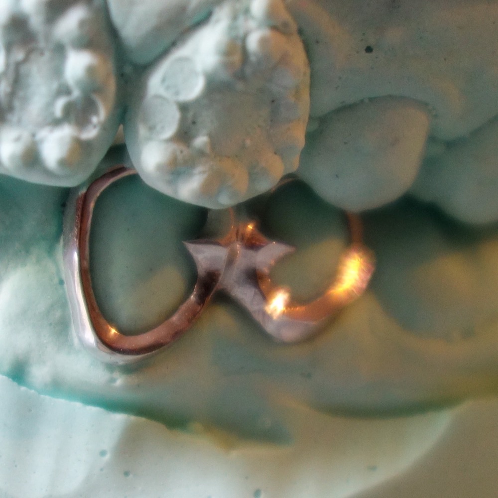 Grillz von vorne — maßgefertigter Zahnschmuck