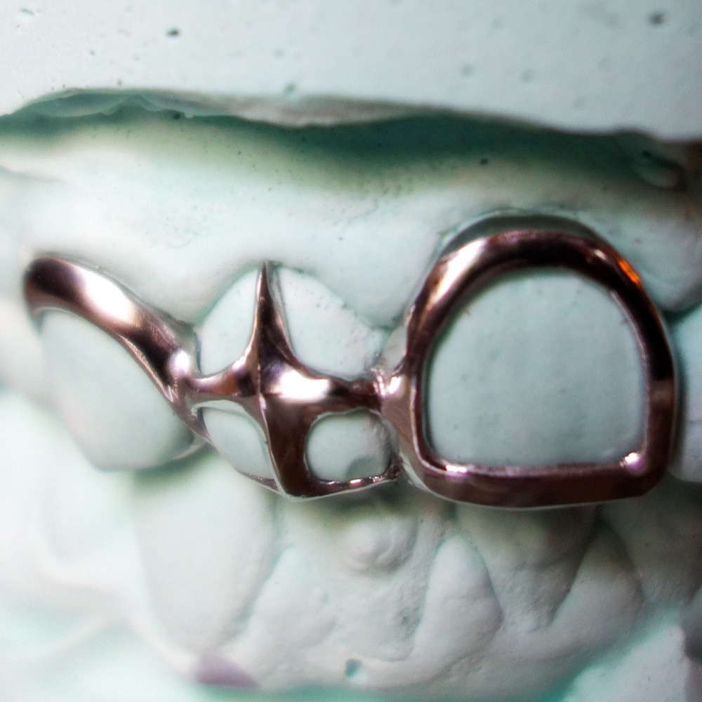 Custom Dental Jewelry — Detailaufnahme Chopper Couture