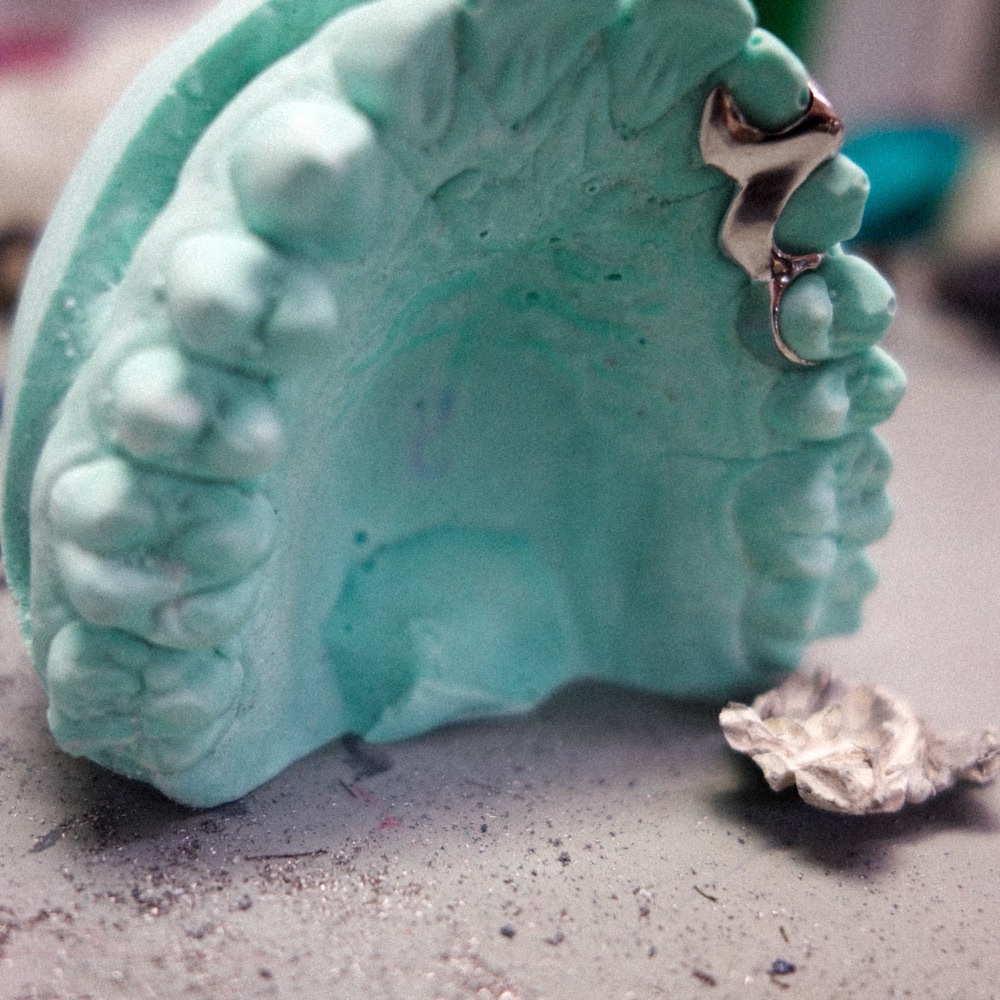 Dental Jewelry Piece — handgefertigt in Berlin