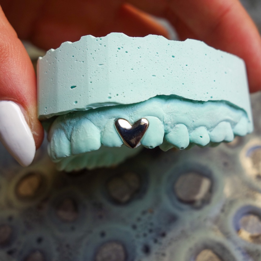 Grillz Nahaufnahme — poliertes CoCr-Design