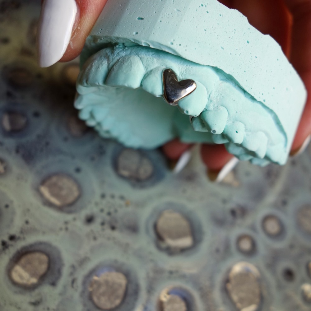 Dental Jewelry — individuelles Piece aus Berlin