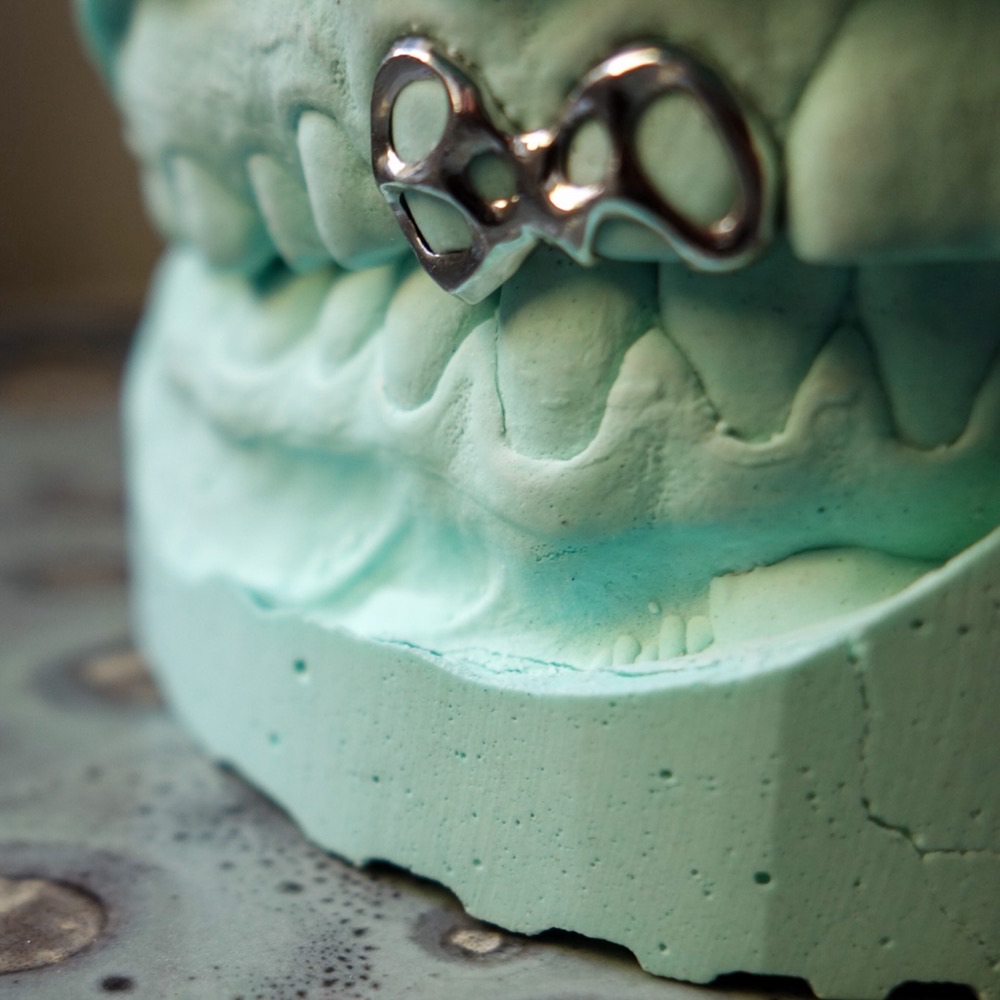 Grillz auf Zahnmodell — Custom Design Nahaufnahme