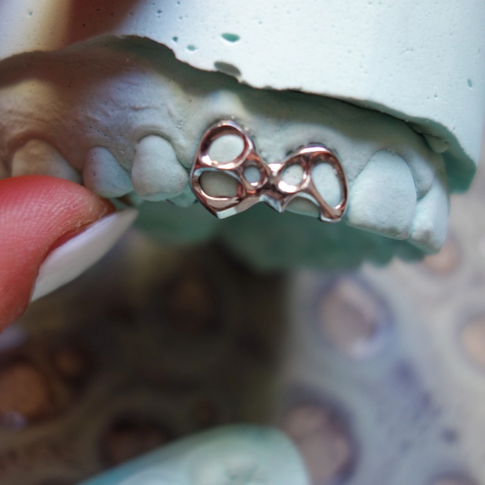Custom Grillz Seitenansicht — polierter Zahnschmuck