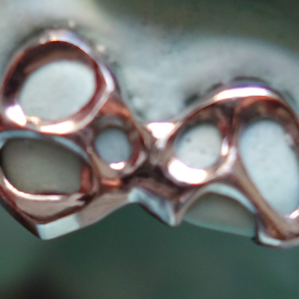 Grillz von oben — maßgefertigtes Design
