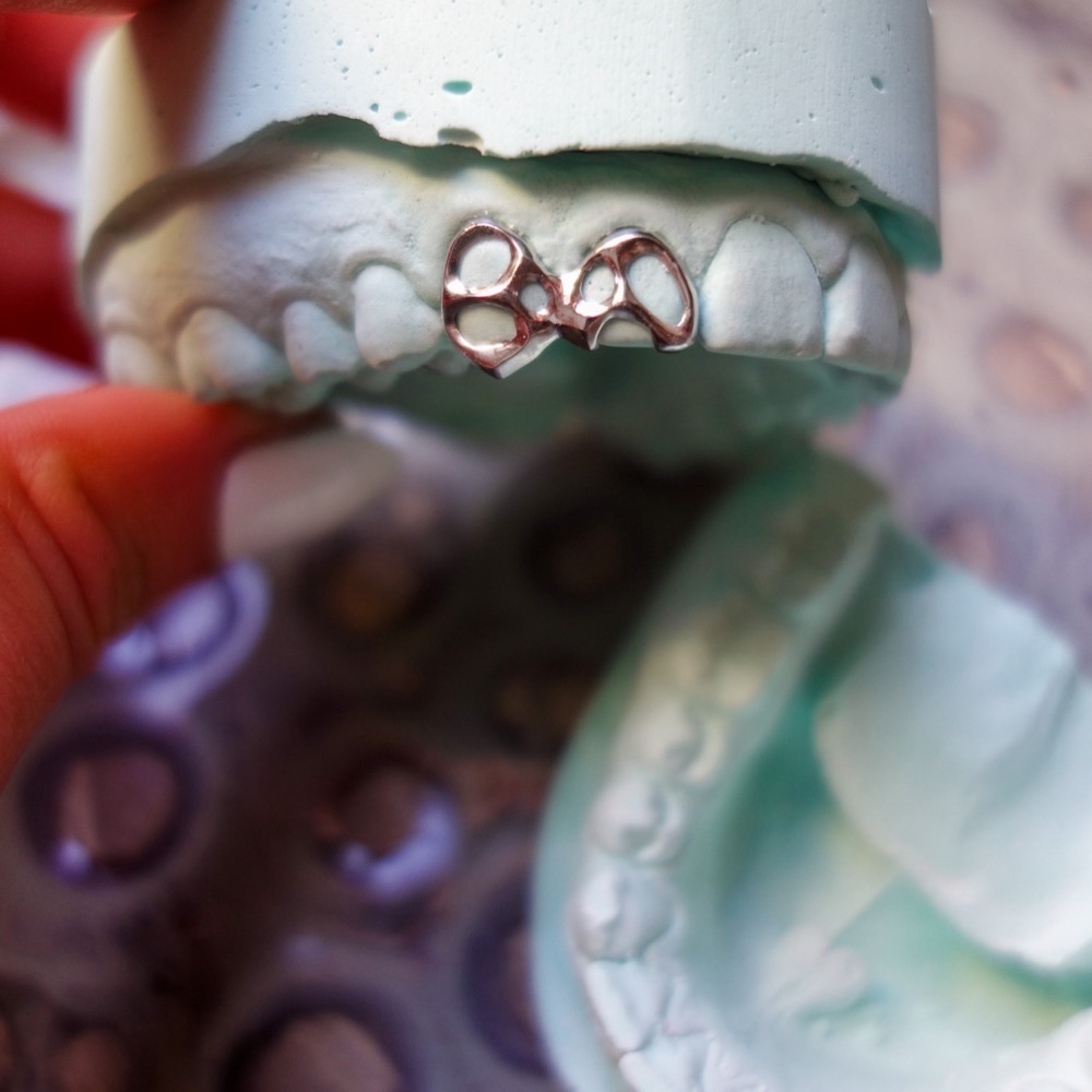 Dental Grillz Piece — Chopper Couture Berlin