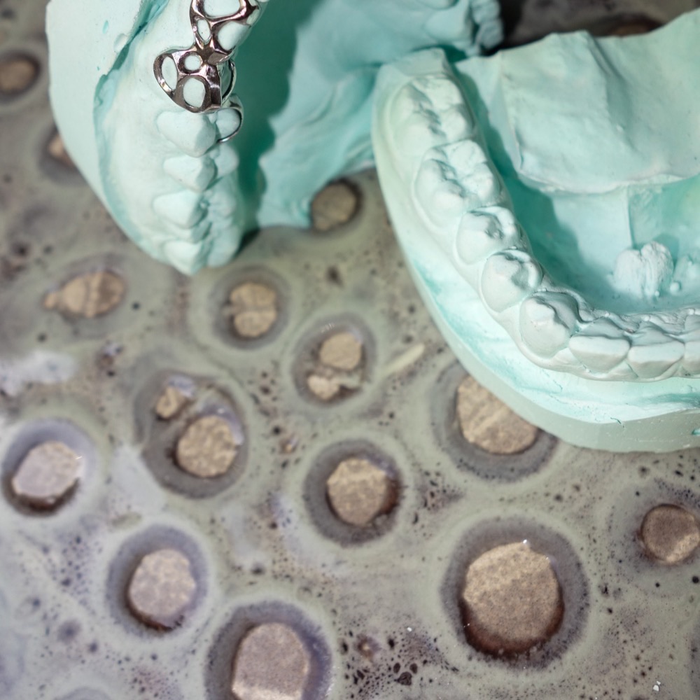 Custom Dental Jewelry — individuelles Ornament