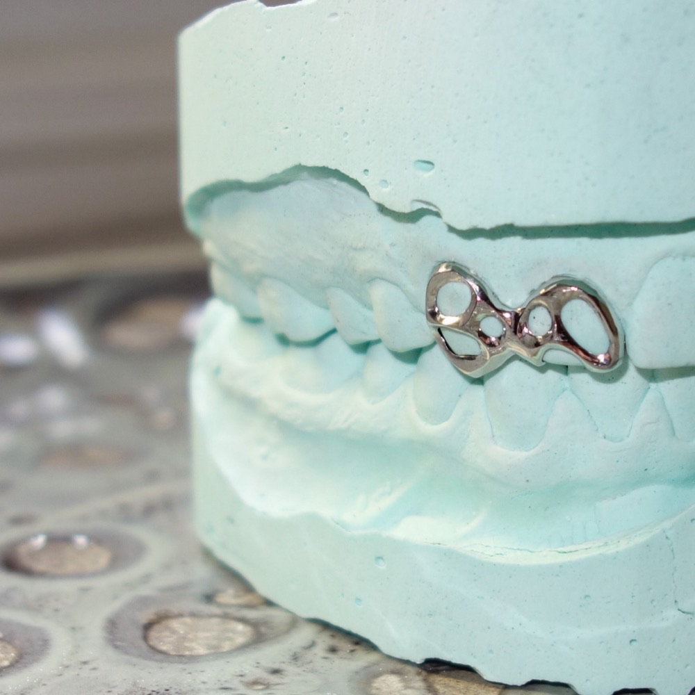 Grillz Nahaufnahme — handpolierter Zahnschmuck