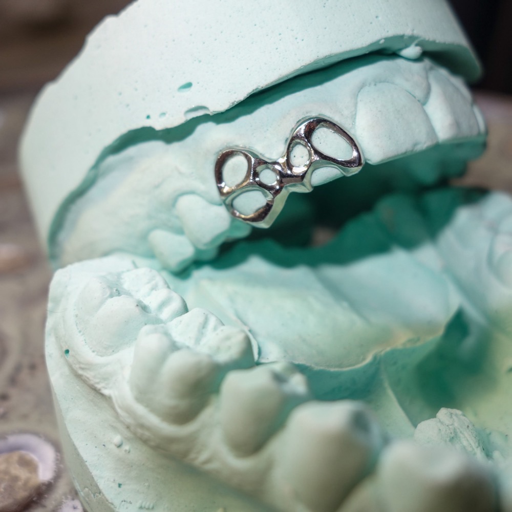 Dental Grillz Gesamtansicht — CoCr-Legierung