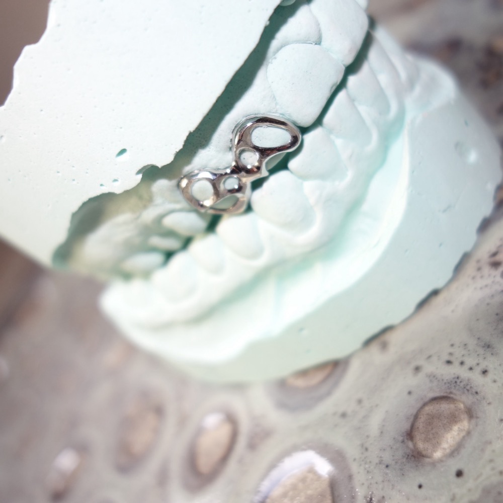 Custom Grillz seitlich — Chopper Couture Design