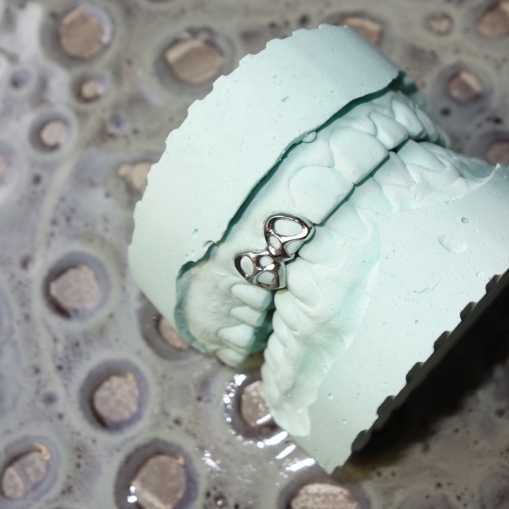 Grillz mit Details — individueller Zahnschmuck