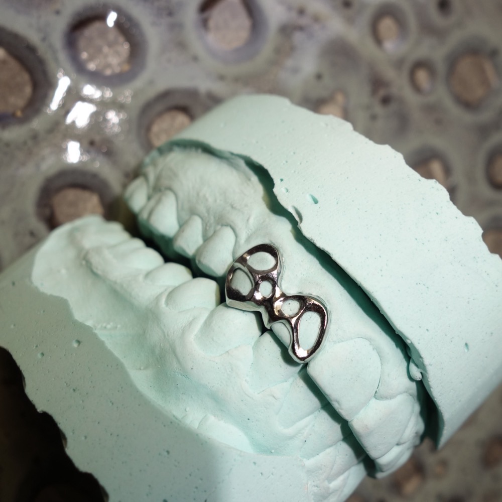 Dental Jewelry Piece — maßgefertigt Berlin