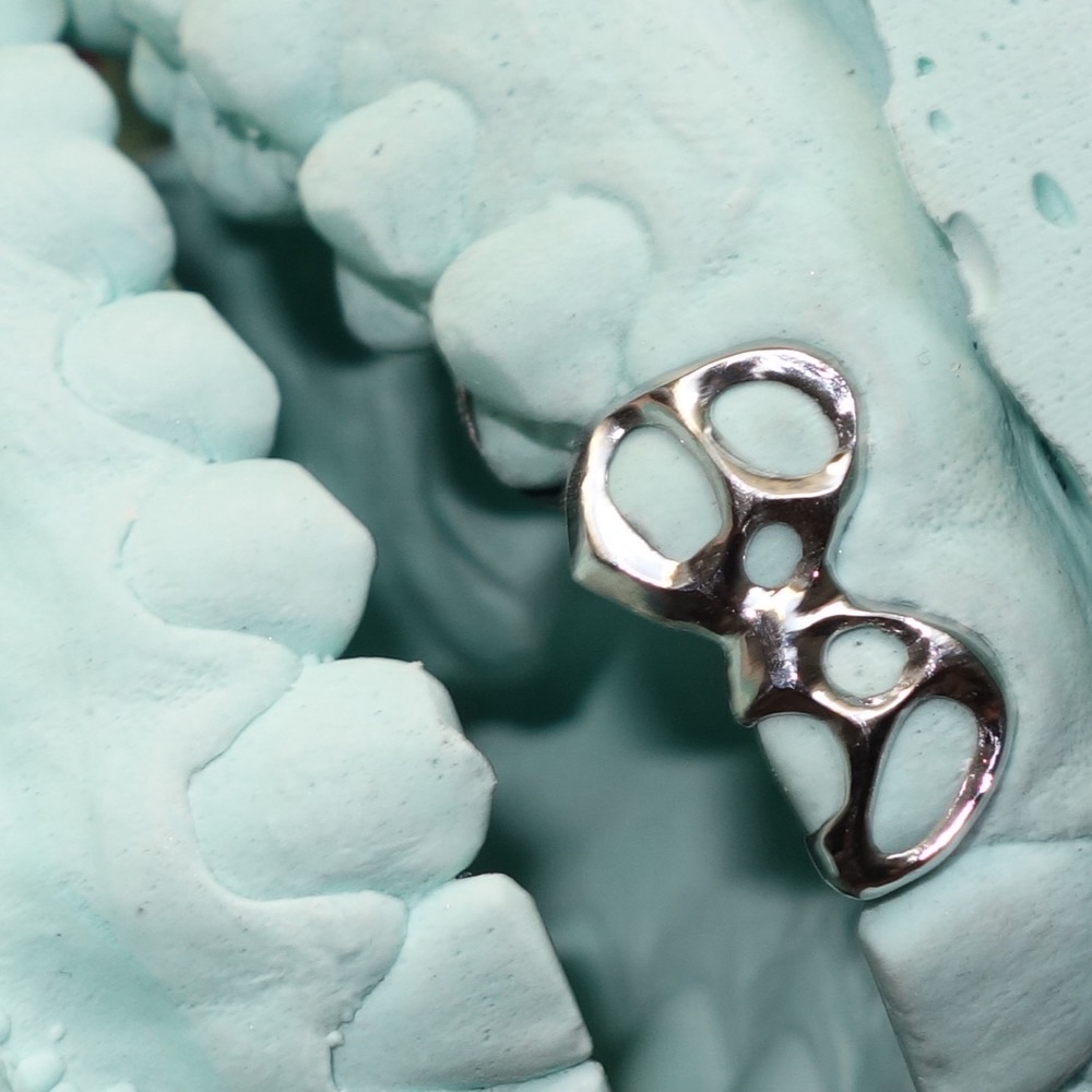 Zahnschmuck Präsentation — Chopper Couture