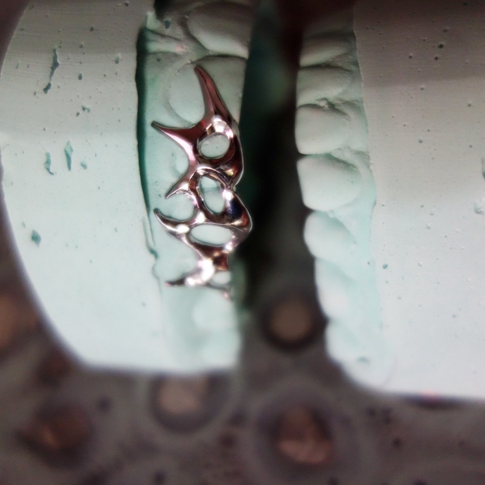 Dental Jewelry Detail — individuelles Zahnschmuck-Piece