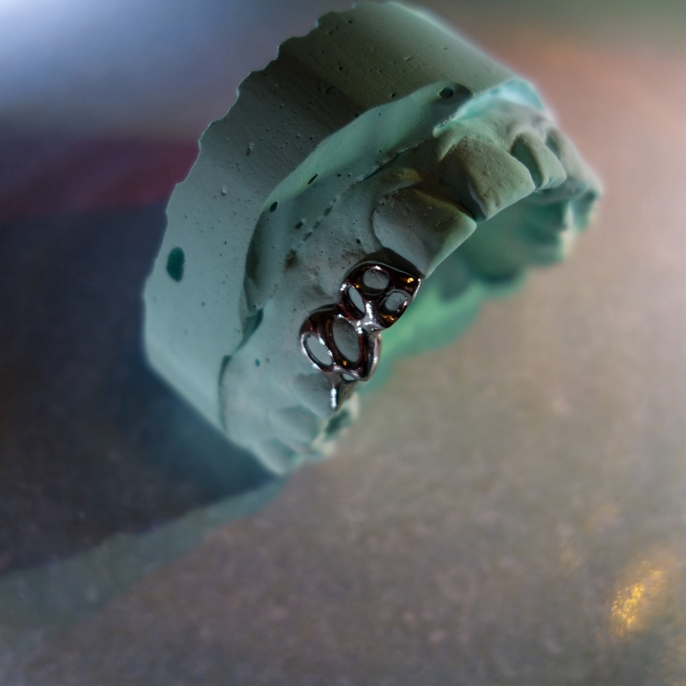 Dental Grillz Seitenansicht — handgefertigt