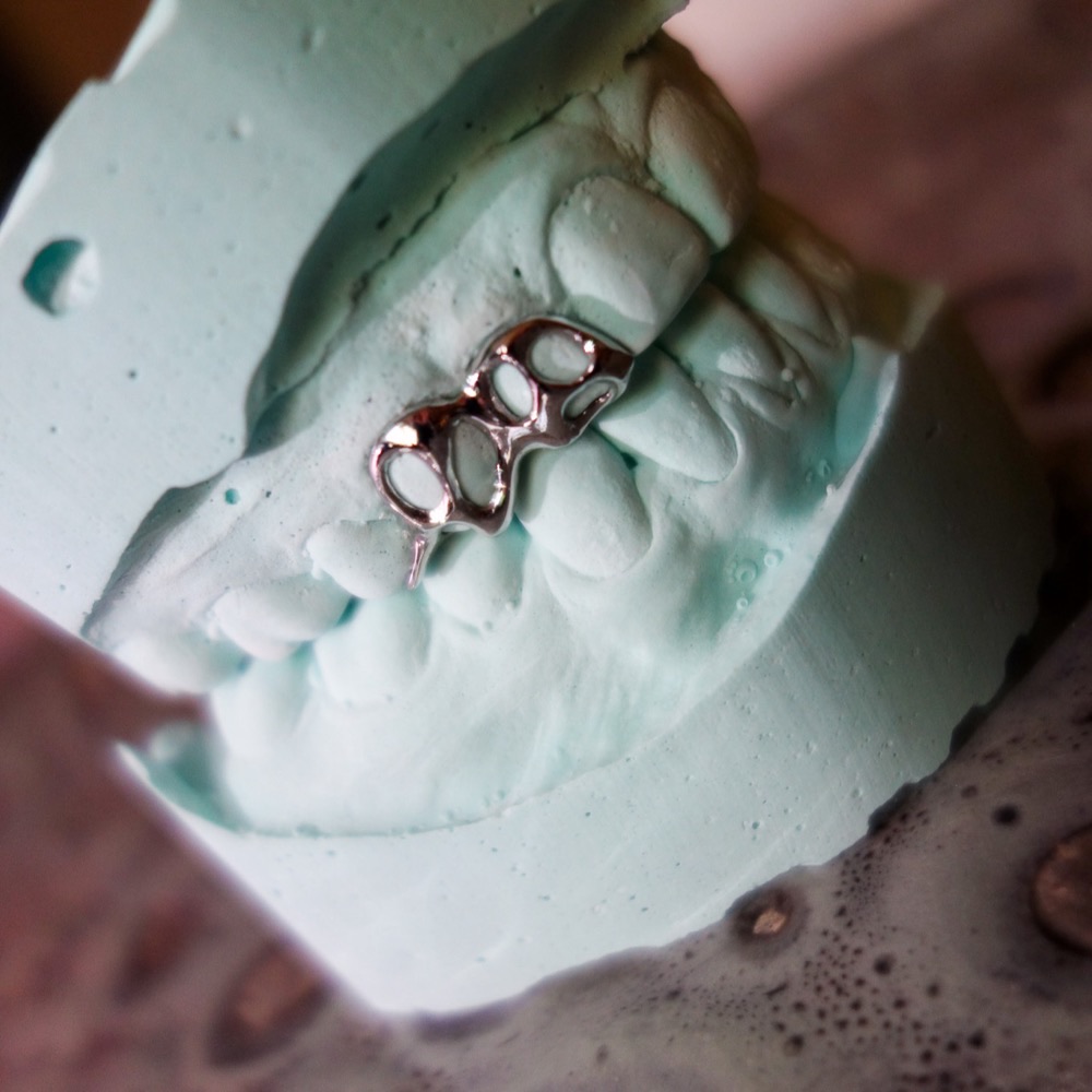 Dental Jewelry Nahaufnahme — handgefertigter Zahnschmuck