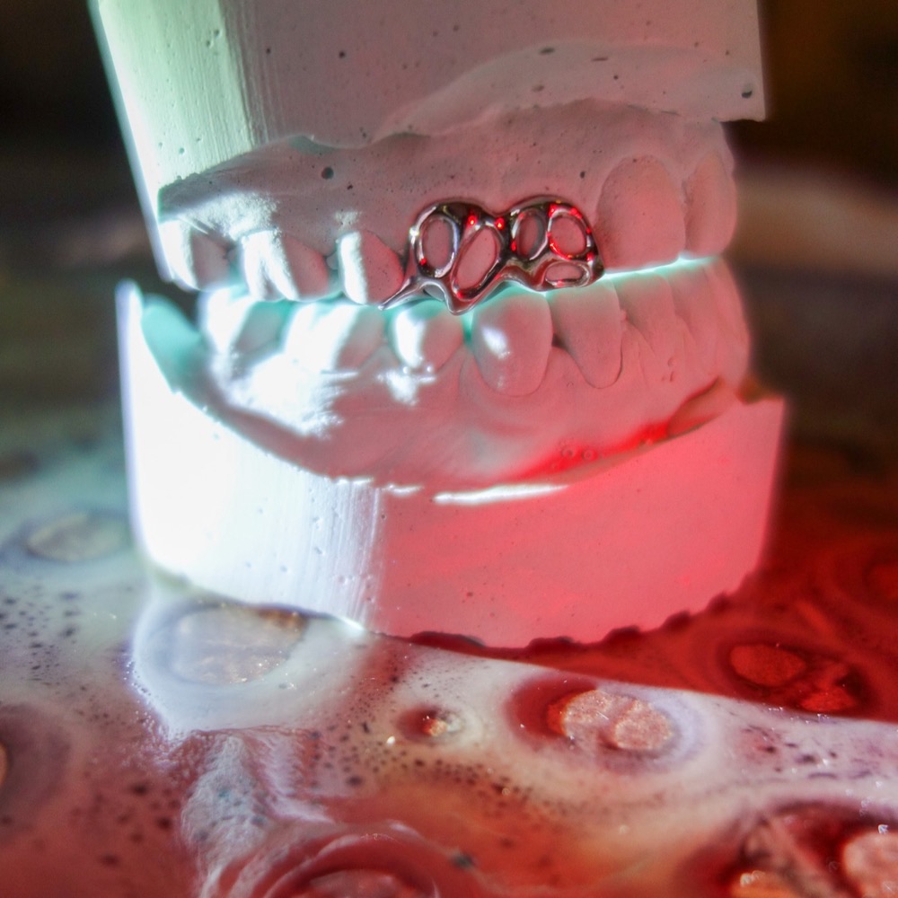Dental Grillz — individuelles Ornament-Design