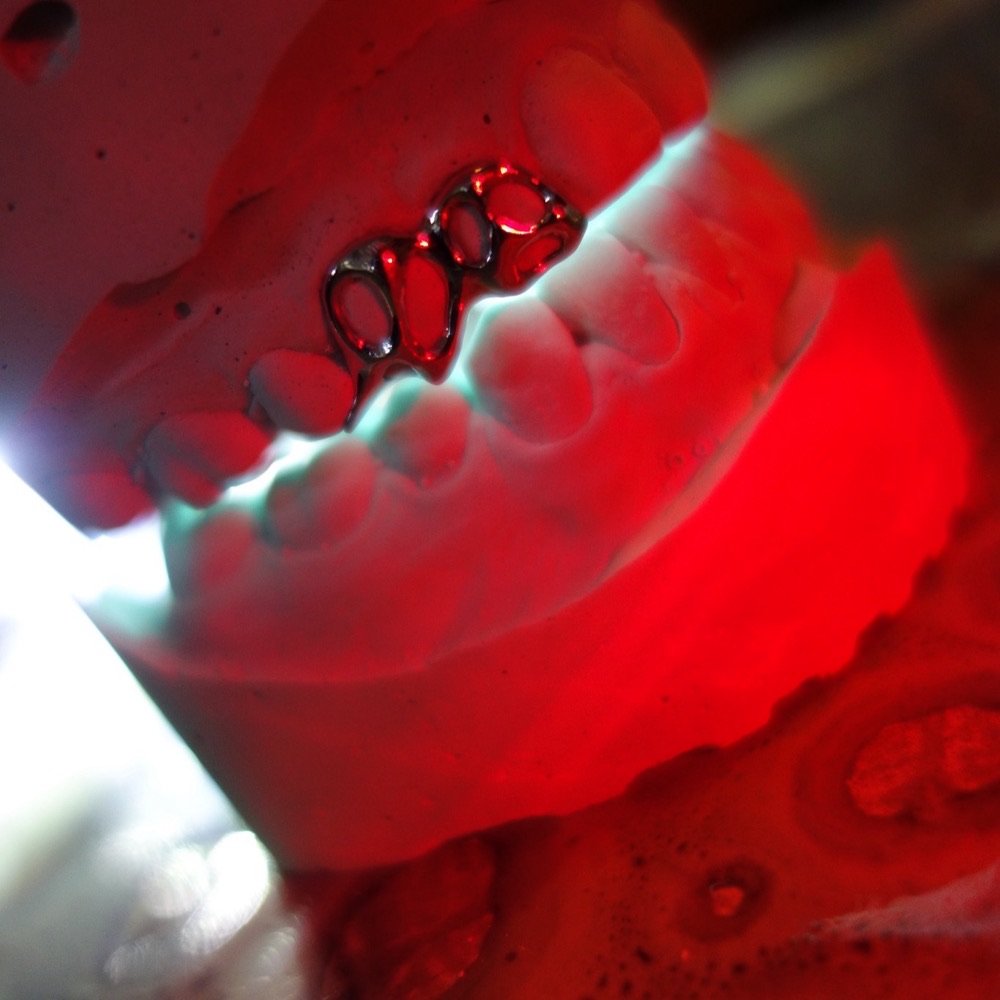 Custom Dental Jewelry — maßgefertigter Zahnschmuck