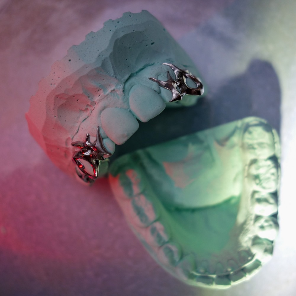 Grillz Nahaufnahme — Custom Design poliert