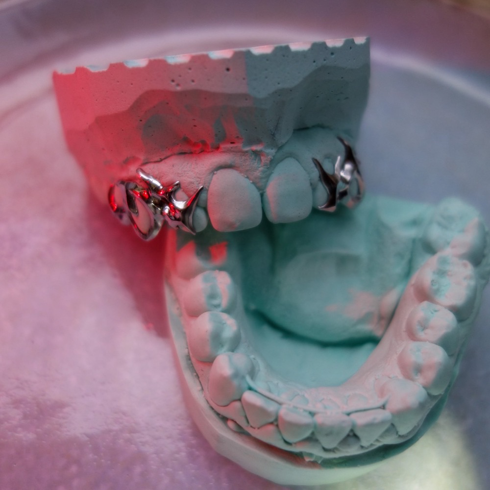 Dental Jewelry Piece — handgefertigt Chopper Couture