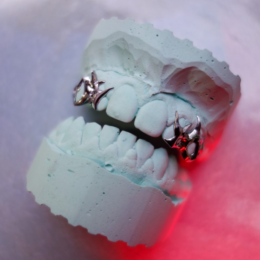 Grillz seitliche Ansicht — individuelles CoCr-Design