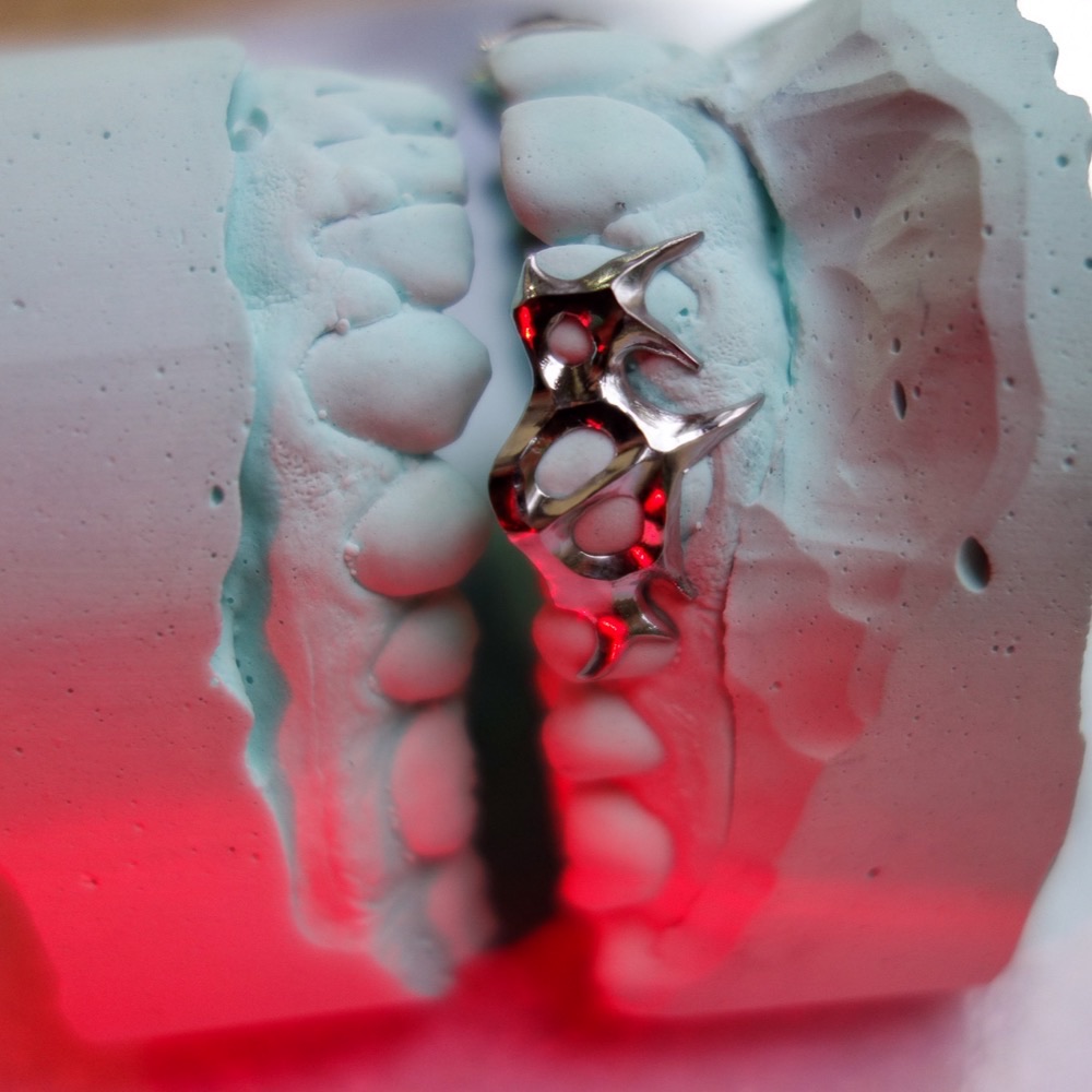 Dental Grillz — maßgefertigter Zahnschmuck Berlin