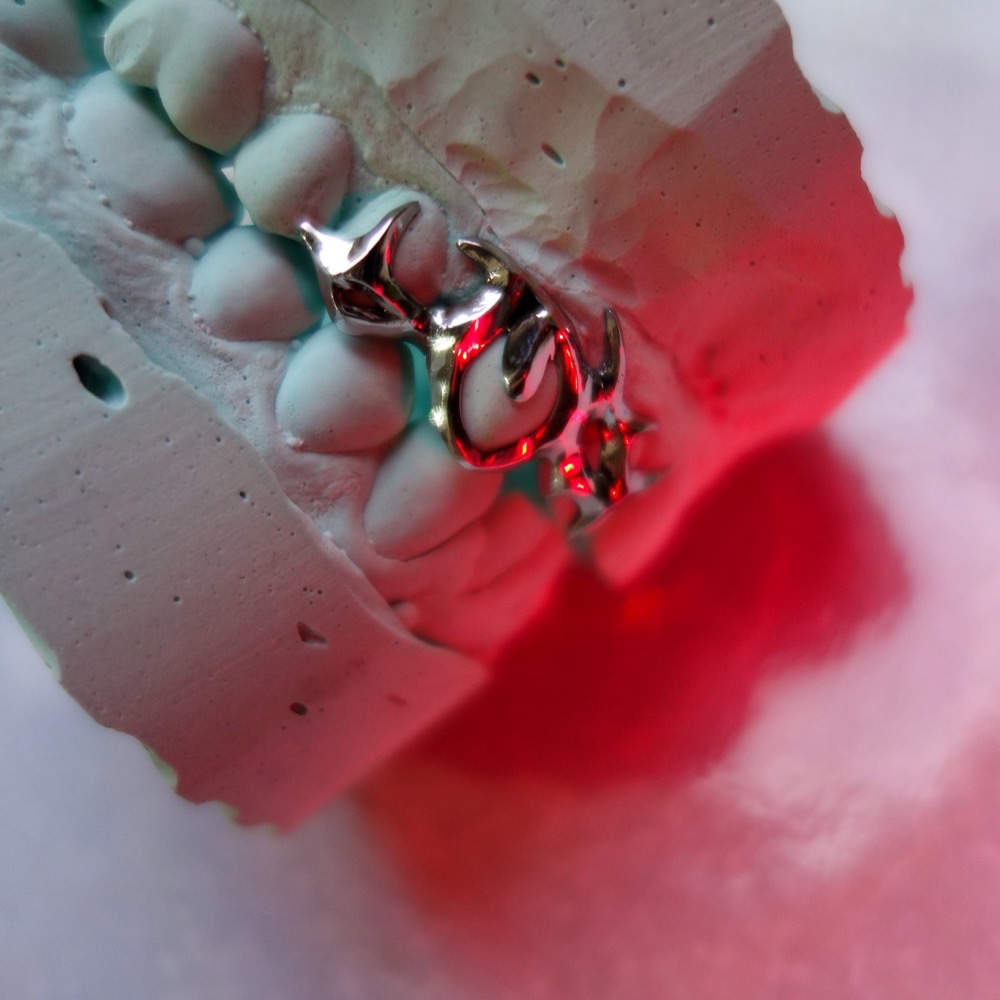 Custom Dental Jewelry — Ornament-Grillz poliert