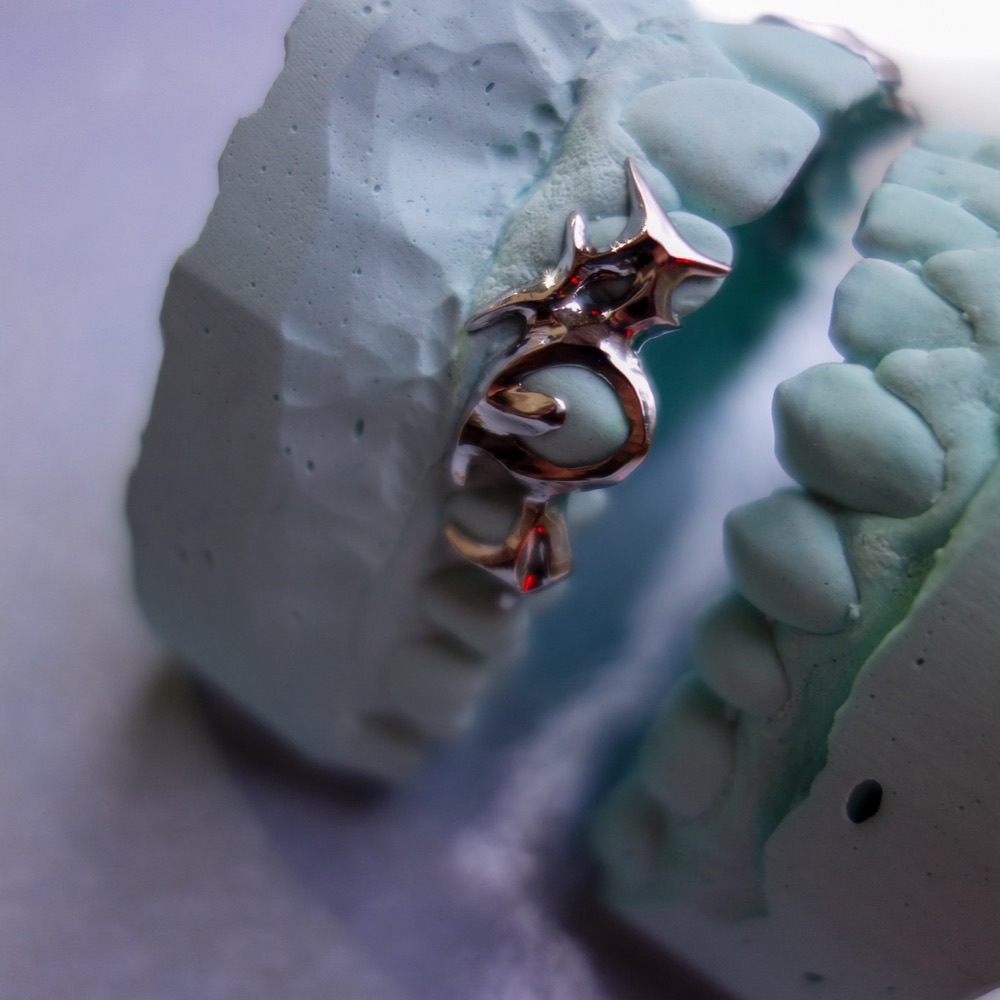 Grillz Gesamtansicht — handgefertigtes Unikat