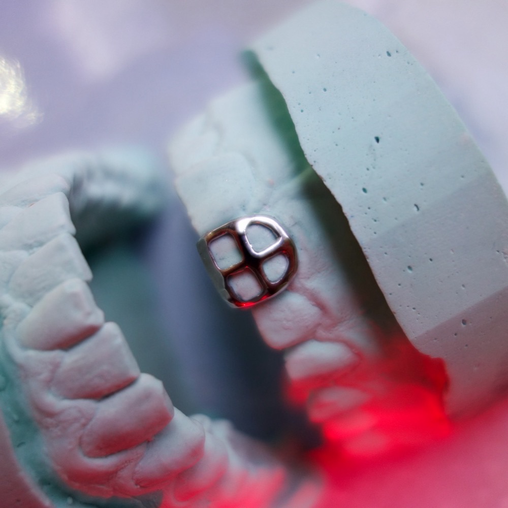 Custom Grillz siebtes Design — Chopper Couture Berlin