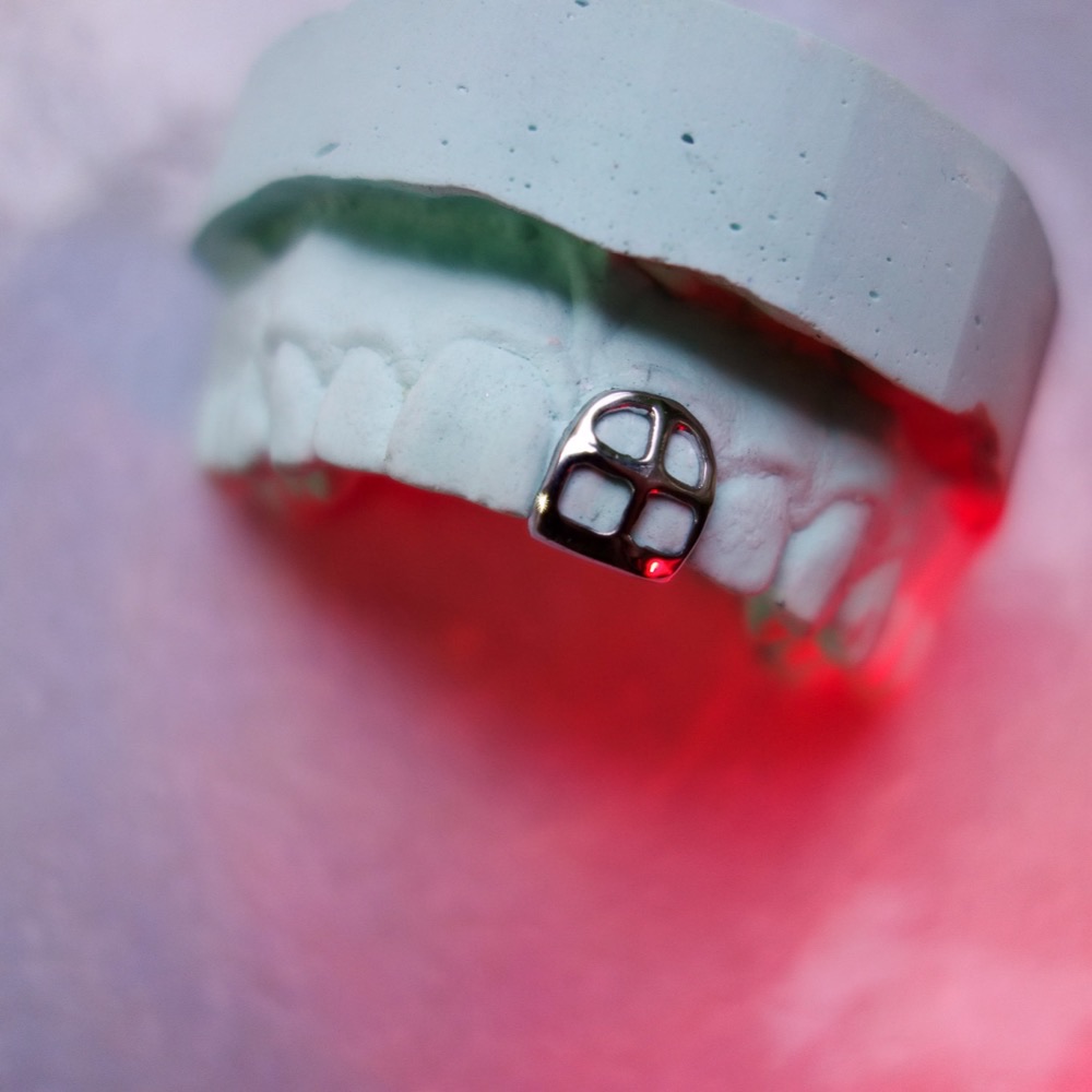 Dental Jewelry Detail — individueller Zahnschmuck CoCr
