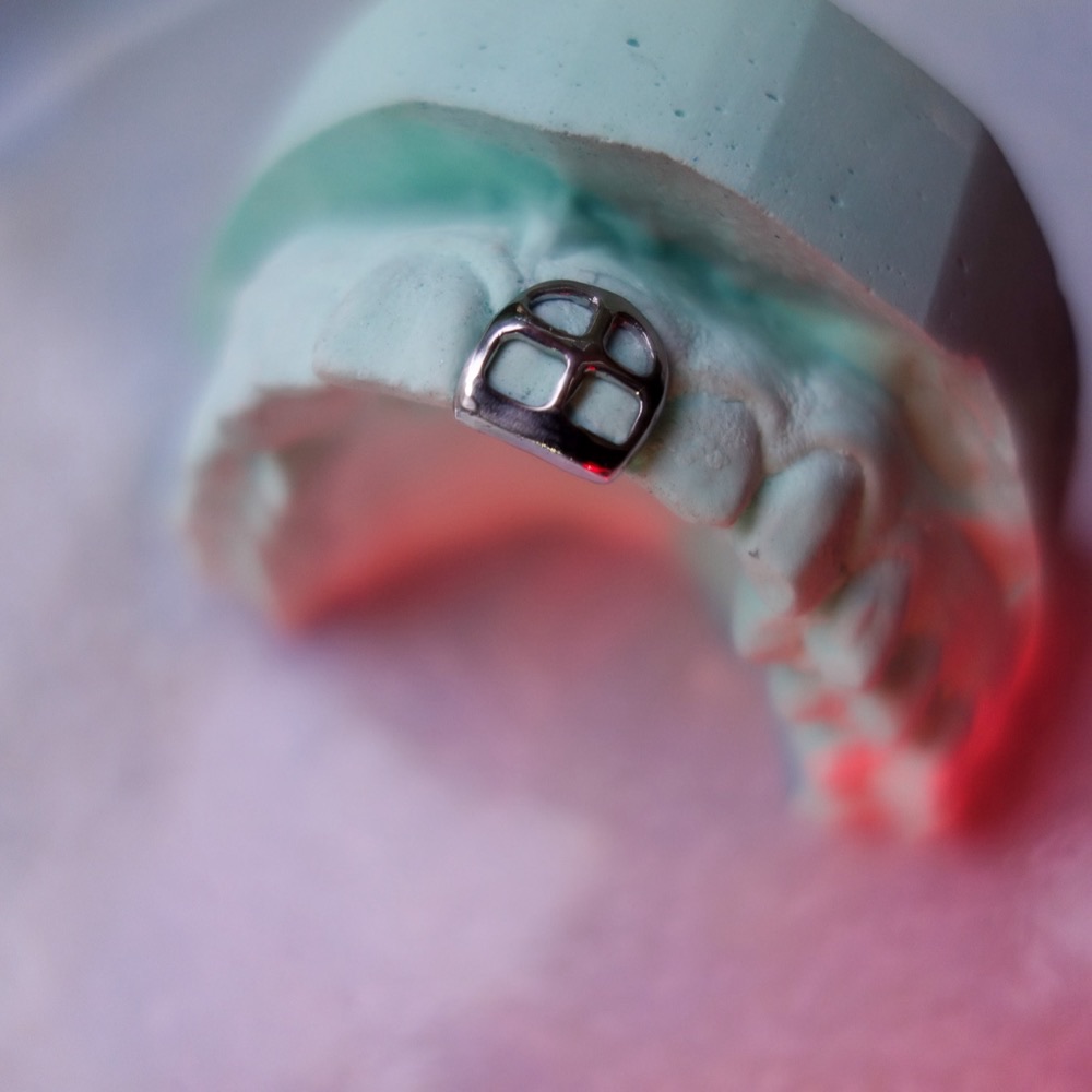 Grillz auf Zahnmodell — Custom Design Nahaufnahme