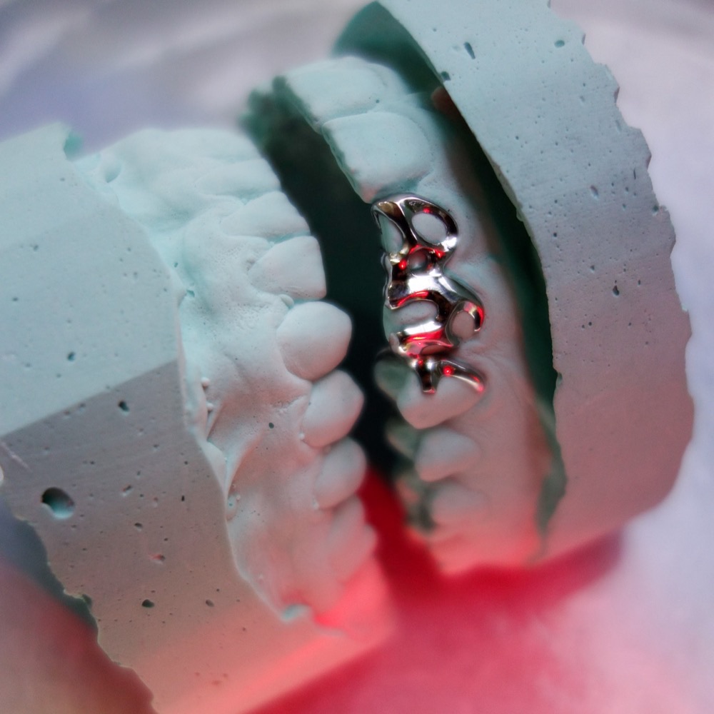 Grillz Nahaufnahme — CoCr-Zahnschmuck poliert