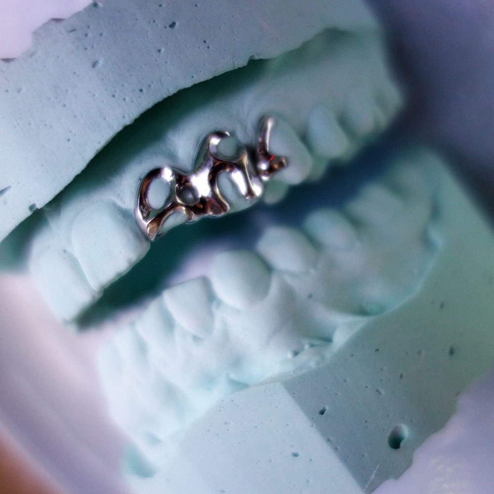 Dental Grillz Seitenansicht — Chopper Couture
