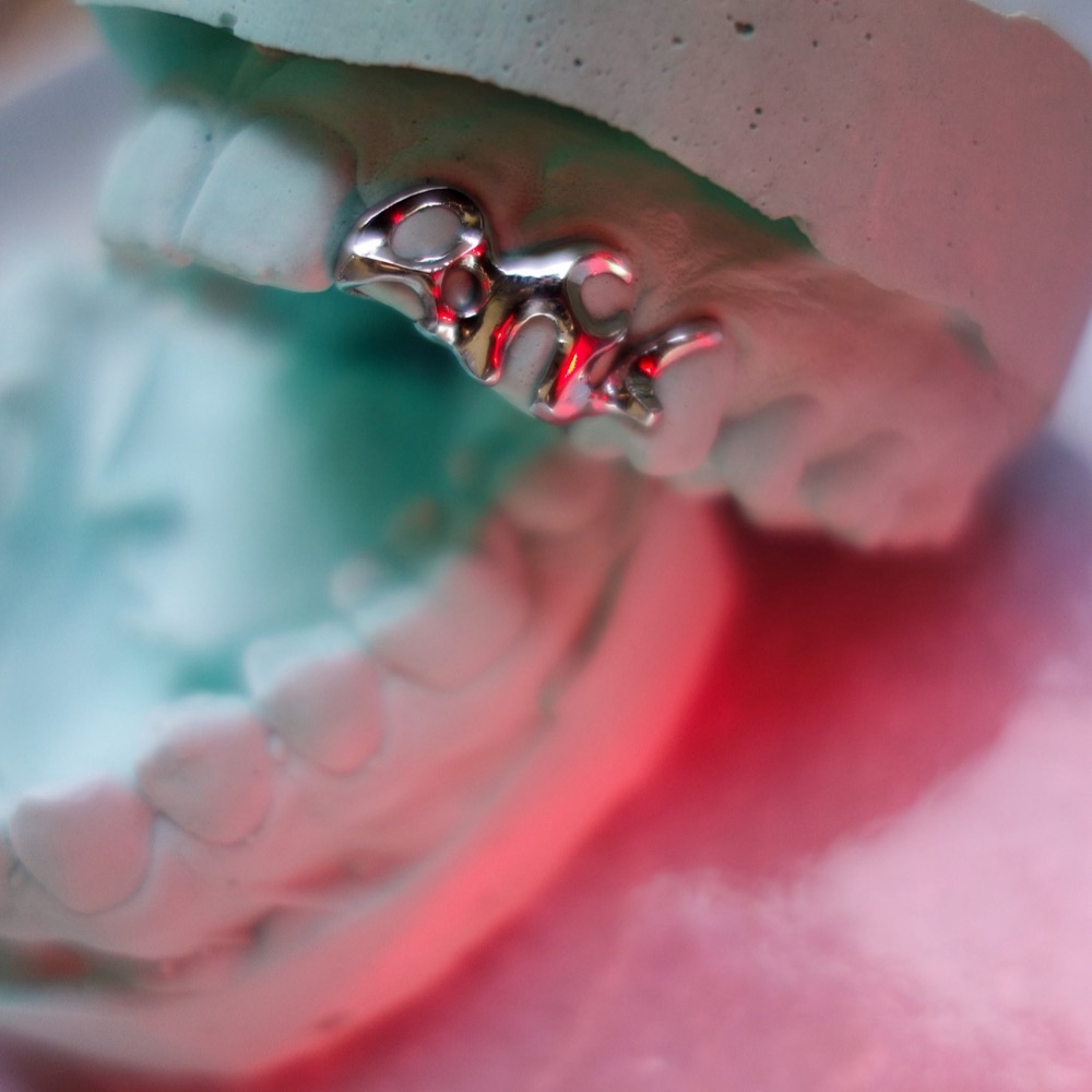 Custom Dental Jewelry — handgefertigtes Ornament