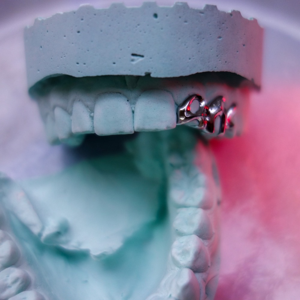 Grillz Detail — maßgefertigter Zahnschmuck Berlin