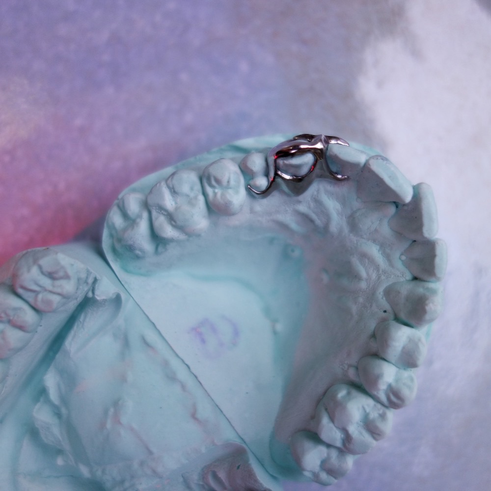 Zahnschmuck Detail — Custom Grillz poliert