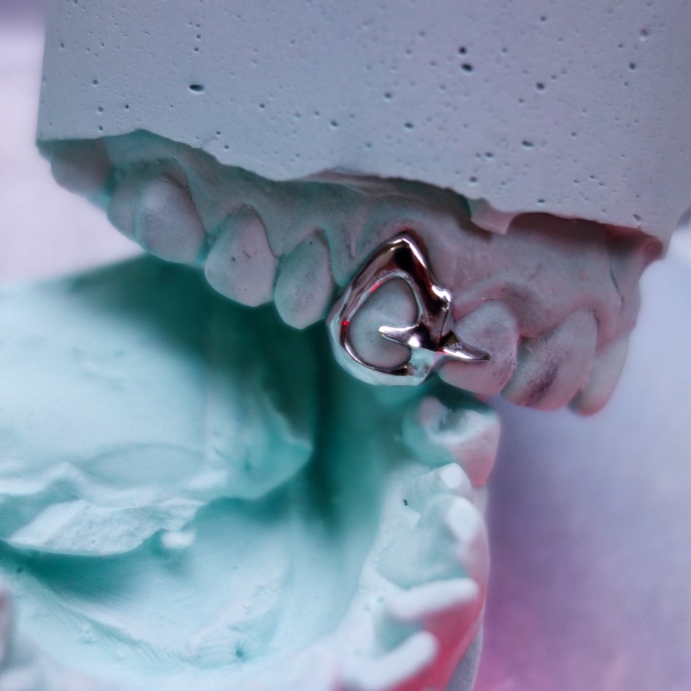 Dental Grillz Gesamtansicht — Chopper Couture Berlin