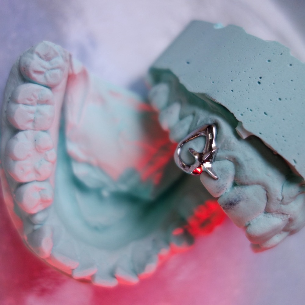 Custom Dental Jewelry — maßgefertigtes Unikat